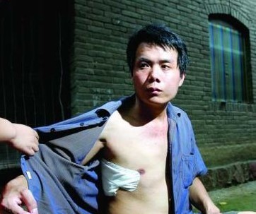 塵肺病的相關(guān)知識